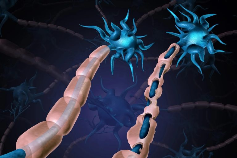 Guillain-Barré Syndrome.jpg (1)