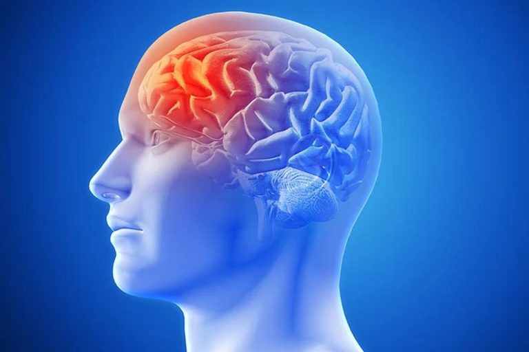 Movement Disorder.jpg