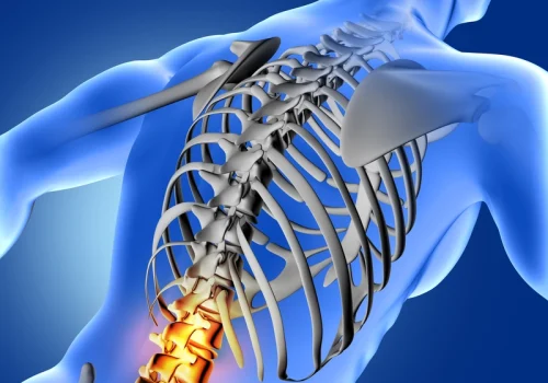 Transverse Myelitis